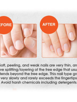 Nail-Tek-Nail-Tek-Intensive-Therapy Before and after