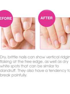 Nail-Tek-Protection-Plus-3---Strengthener-for-Hard-and-Brittle-Nails-before-after